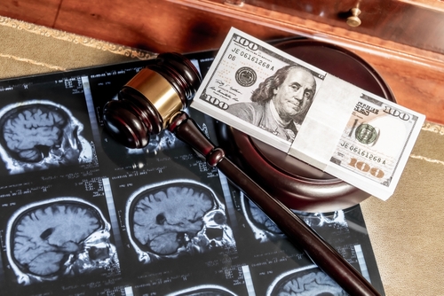 What is the average payout for a brain injury